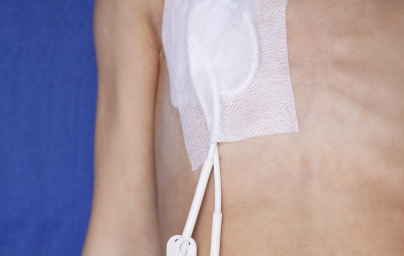 8 SIMPTOME TIMPURII ALE CANCERULUI. NU LE IGNORA!