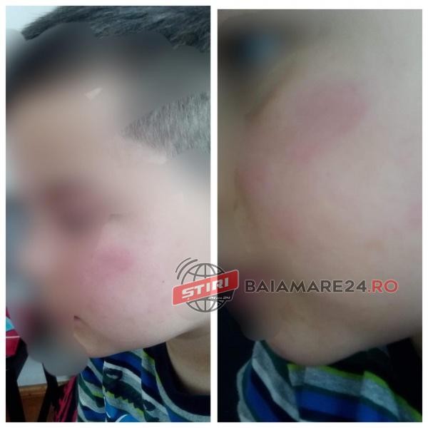 Copilul a fost lovit în sala de clasă sursa foto: BaiaMare24
