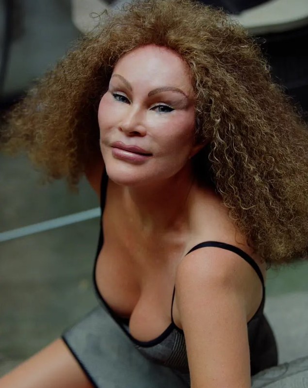 Jocelyn „Catwoman” Wildenstein a murit. Cea mai cunoscută victimă a chirurgiei plastice avea 84 de ani