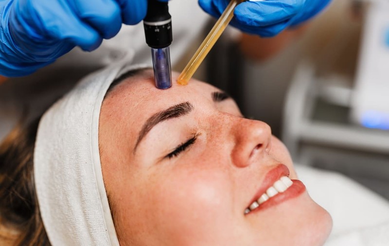 Microneedling: eficiență și rezultate rapide pentru un ten perfect