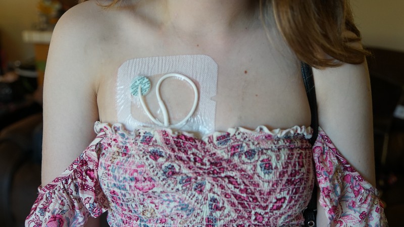 O tânără din Statele Unite este ținută în viață de o geantă cu medicamente