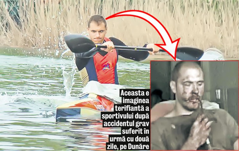 Desfigurat! Kaiacistul Iustin Porcăraşu a suferit un grav accident, pe Dunăre | VIDEO