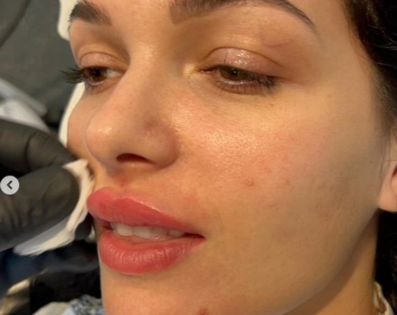 Deea Maxer și-a mărit din nou buzele cu acid hialuronic. Cum au reacționat fanii: „Erai frumoasă naturală”