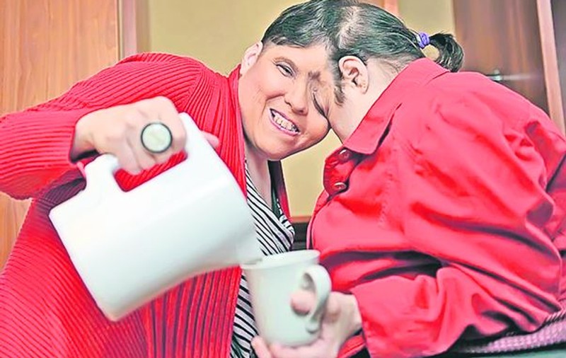Cele mai bătrâne siameze din lume, Lori şi Dori, împlinesc 50 de ani