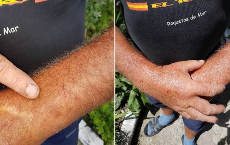 Încătușat, după ce a ajutat o bătrână în Petrila. Grave acuzații la adresa polițiștilor hunedoreni