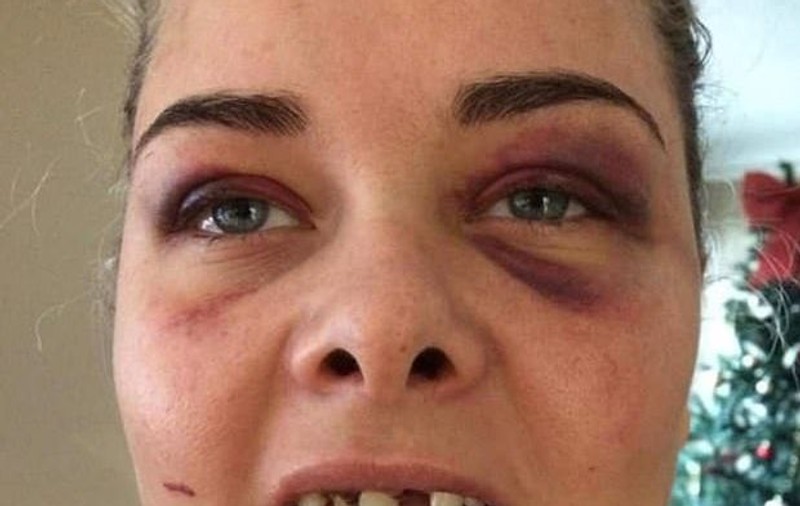 Un bărbat și-a bătut iubita și i-a spart trei dinți din cauză că a schimbat poza de pe Facebook și el nu mai apărea în ea
