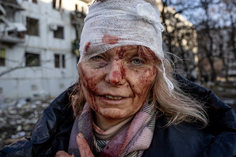 Anadolu Agency's Best Pictures of 2022: (EDITORS NOTE: Image depicts graphic content) A wounded woman, named locally as Olena Kurilo, is seen after an airstrike damages an apartment complex outside of Kharkiv, Ukraine on February 24, 2022. Wolfgang Schwan / Anadolu Agency/ABACAPRESS.COM