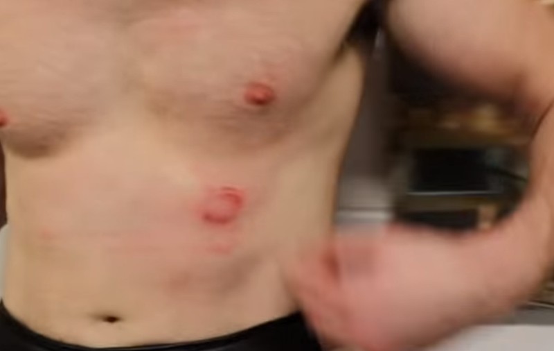Boxerul britanic Kash Ali și-a mușcat adversarul și a fost descalificat | VIDEO