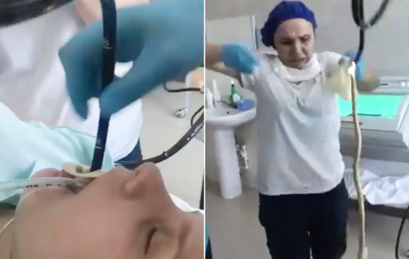 VIDEO | Este reală această operație? Un doctor din Rusia scoate din gura unei femei un șarpe lung de 1,20 metri