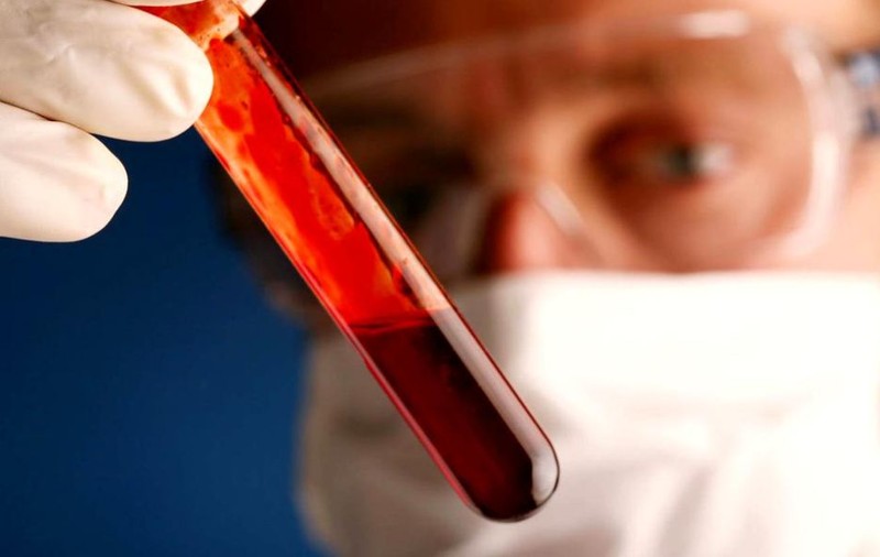 Un test de sânge ar putea detecta cancerul la sân cu cinci ani înaintea primelor simptome