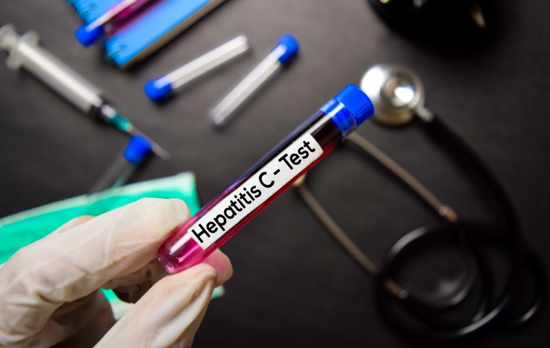 Testări gratuite pentru hepatita B și C pentru toți cei care prezintă simptome, anunță Ministerul Sănătății