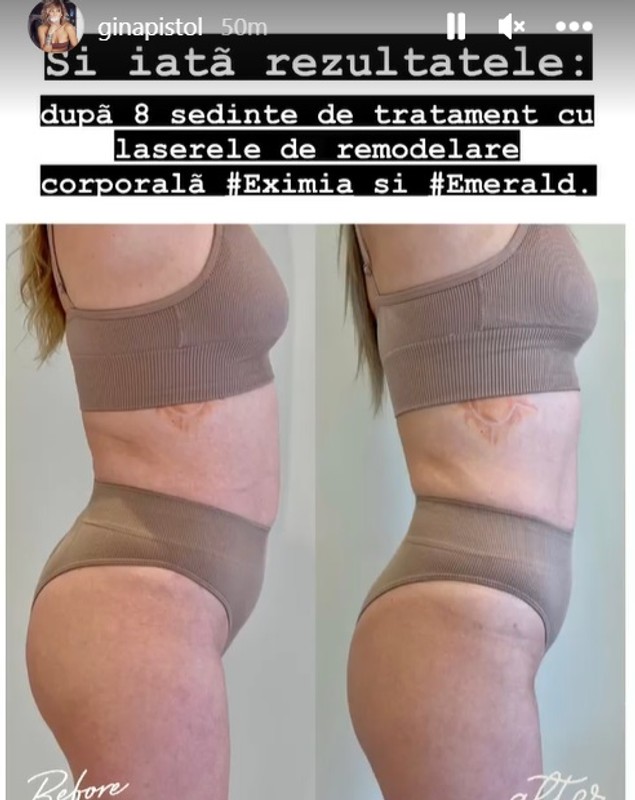 Cum arată Gina Pistol după tratamentele corporale. Prezentatoarea se mândrește cu silueta ei