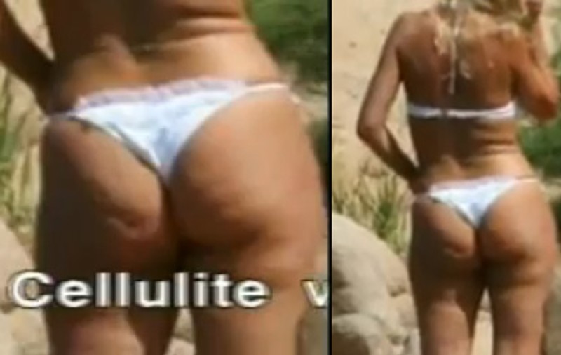 Iubita lui Bote e grasă şi plină de celulită!