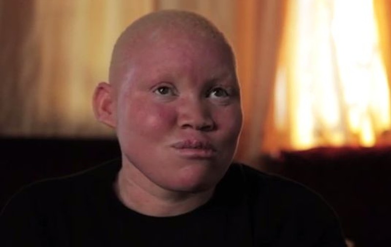 I-au tăiat mâna pe viu ca să o folosească în ritualuri vrăjitoreşti: "Nu pot să descriu durerea pe care am simţit-o"