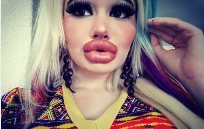 O bulgăroaică s-a operat de 15 ori în ultimul an ca să arate ca păpușa Barbie