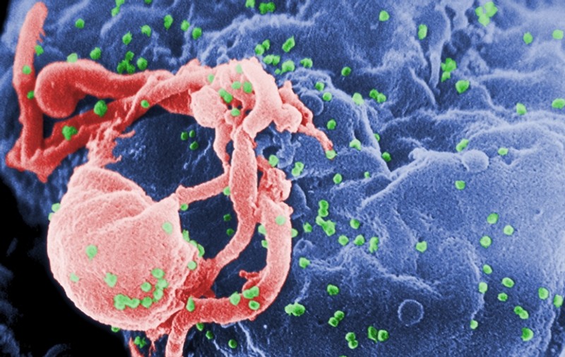 Un copil din Africa de Sud a fost vindecat de HIV. Medicii nu își explică cum s-a reușit