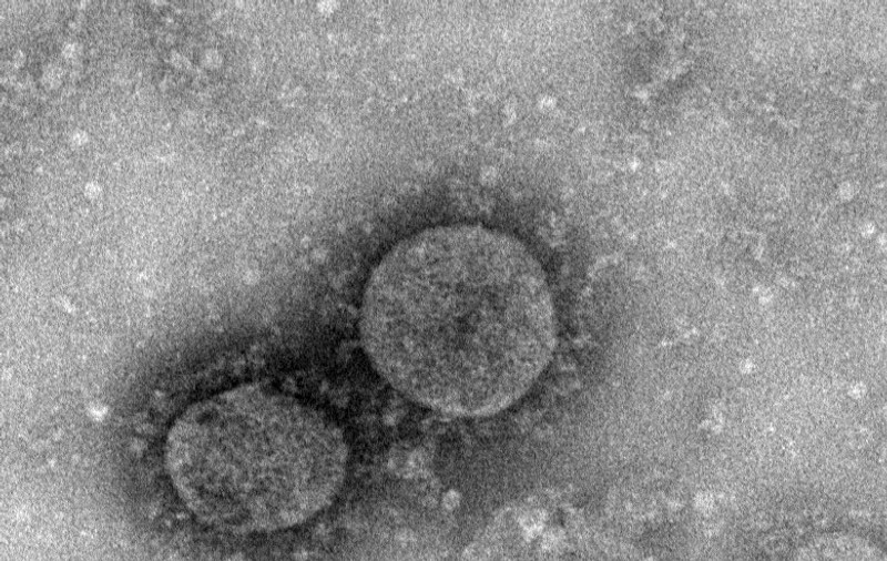 Matematica nu minte: adevăratul număr al celor infectați cu coronavirus este de peste 75.000 de oameni