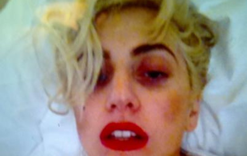 Uite în ce hal arată Lady Gaga, după ce a fost lovită de o bară uriașă, într-un concert! E machiaj sau e pe bune?