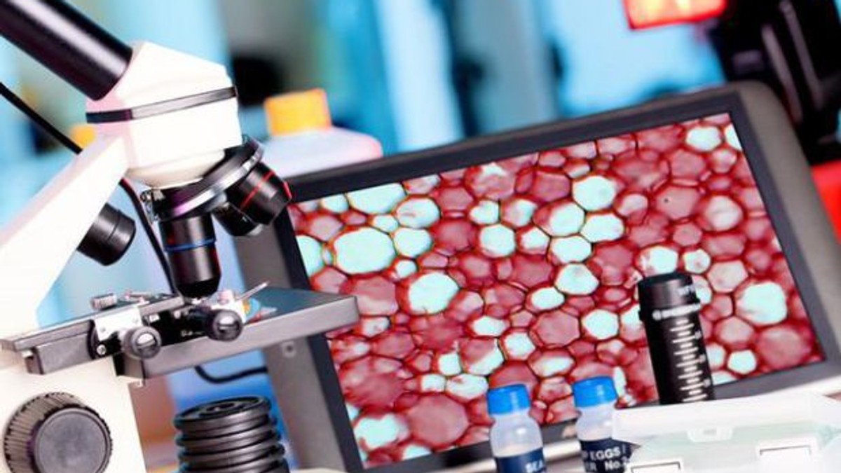 Biopsia lichidă, un nou test pentru bolnavii de cancer