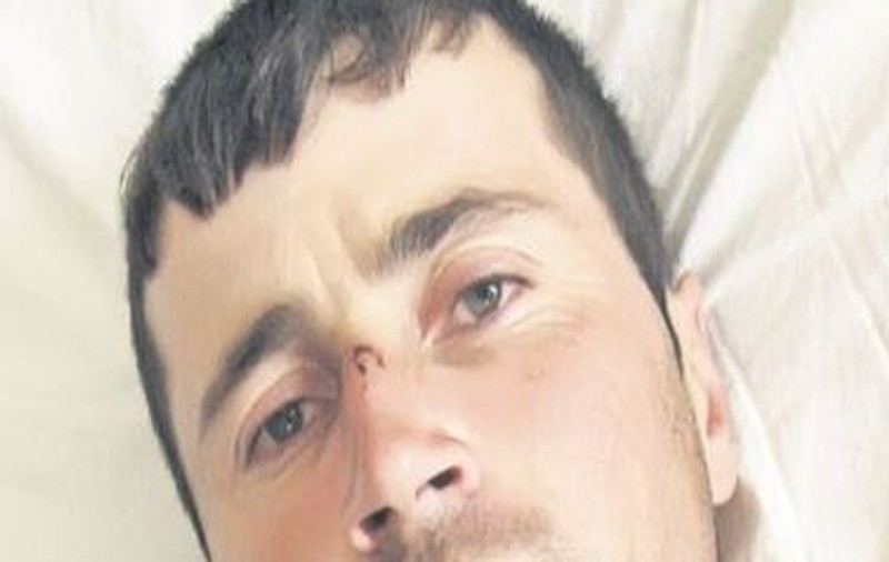 A luat pastile, şi-a zdrobit capul, s-a spânzurat, dar e în viaţă