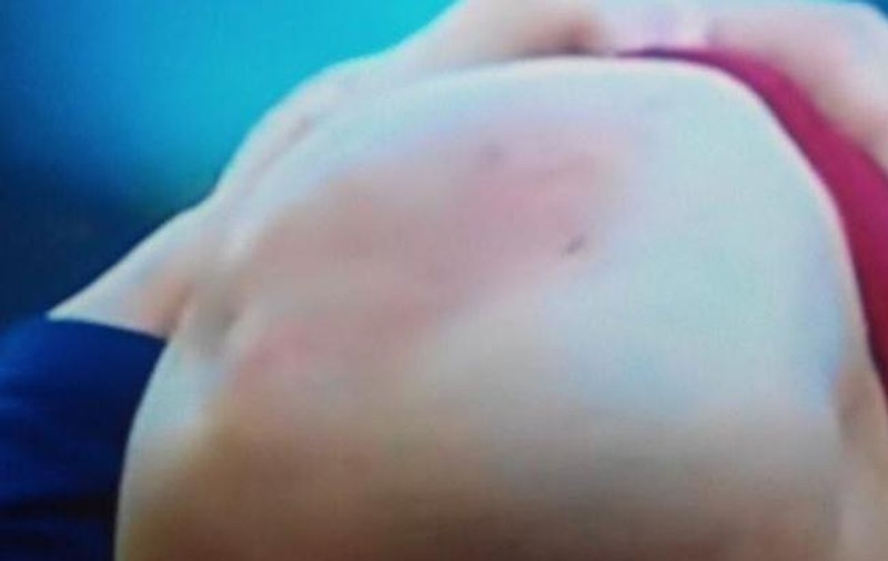 Leo Messi s-a accidentat. ”Puricele” are genunchiul umflat cât un pepene / VIDEO