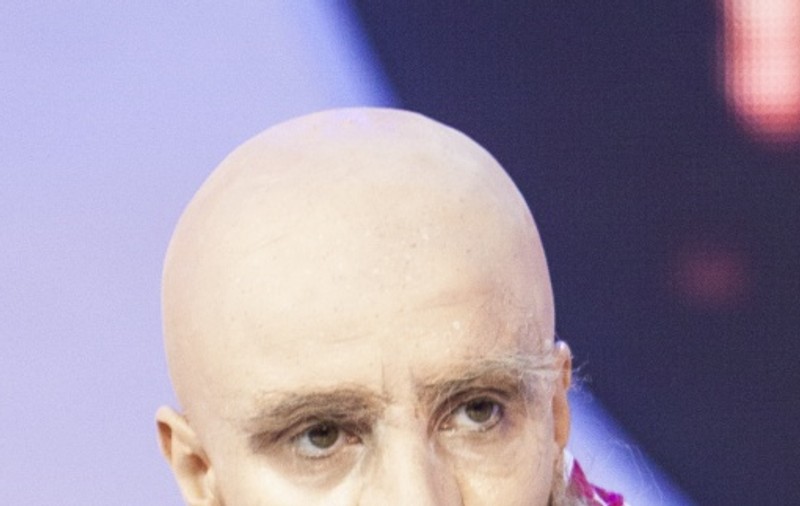 EŞTI TARE dacă o recunoşti! O cântăreaţă de la noi, cheală şi ridată