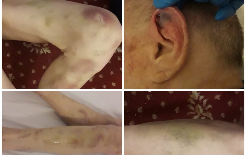 Acuzații de maltratare și neglijență la un azil din Câmpina. „Tata mi-a spus că acolo era pușcărie”