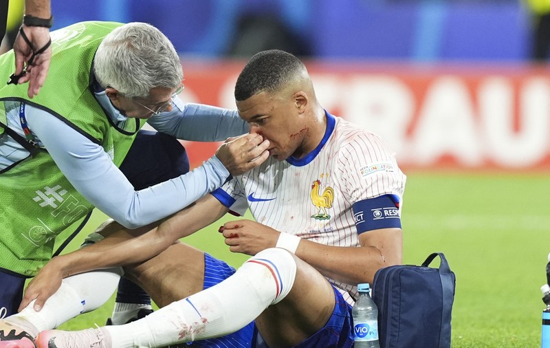 EURO 2024 | Mbappé, aut cu olandezii, după ce și-a spart nasul în meciul cu Austria, anunță L'Équipe