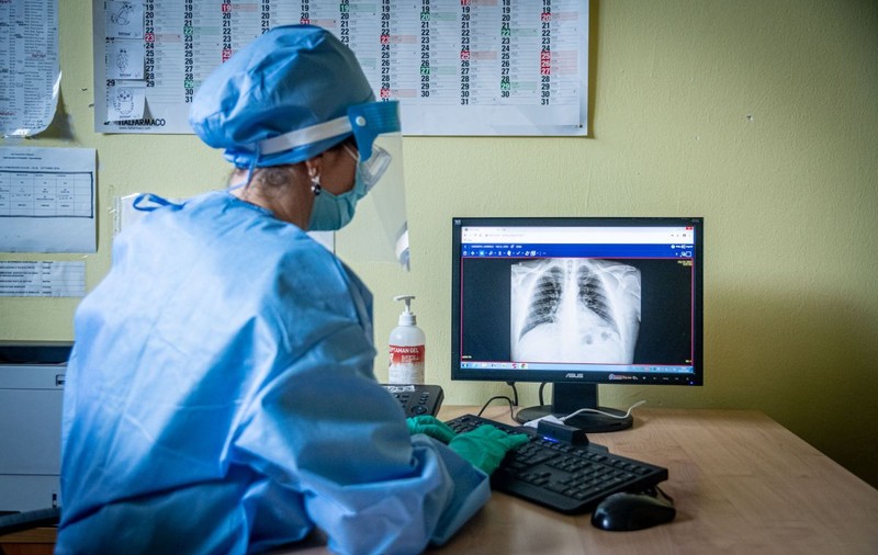 Medicii au fost șocați când au văzut radiografia unui bărbat care a mers la spital cu dureri în piept. Ce au descoperit