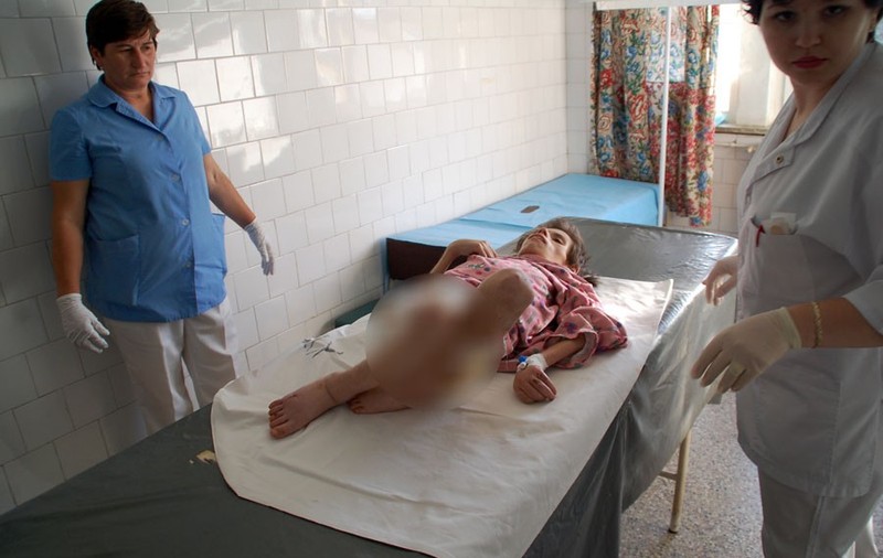Mama tinerei de 16 ani care cântăreşte 13 kg spune că nu şi-a înfometat fiica
