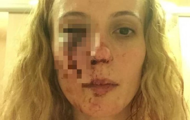 Româncă bătută de mai mulți tineri în Anglia. "Le-am spus să vorbească mai încet că dorm copiii"