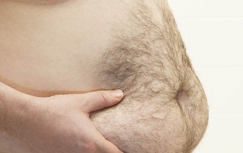 Peste 12% dintre arădeni sunt obezi