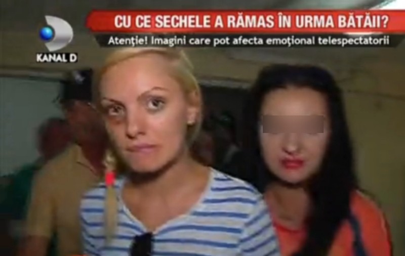 Starea Alexandrei Stan S-A SCHIMBAT! Uite CUM ARATĂ ASTĂZI
