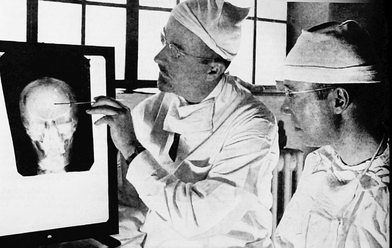 Studiul creierului, de la cimpanzei până la inteligența artificială. „Creierul lui Einstein era de mărime chiar puțin sub medie. La Lenin, comuniștii au oprit experimentele”