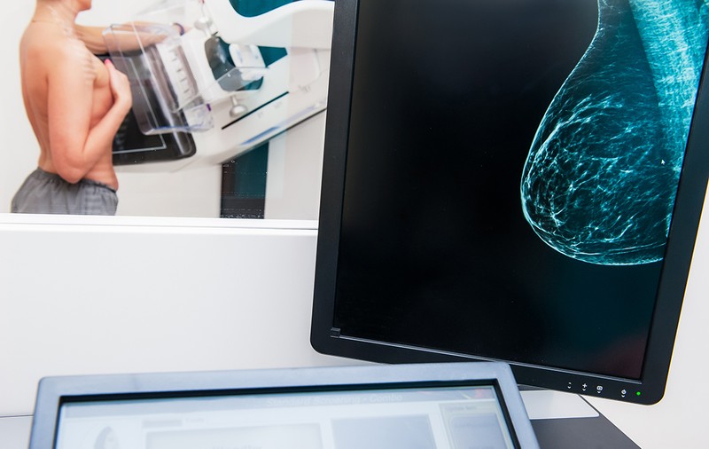Peste 70.000 de femei au fost amânate la screeningul cancerului la sân. Cum a afectat pandemia managementul cancerului