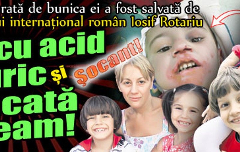Şocant! Fata adoptată de Rotariu, arsă cu acid sulfuric şi aruncată pe geam!