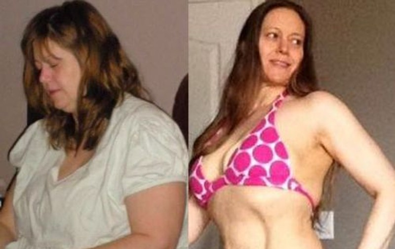FOTO | O femeie care avea 120 de kilograme susține că a pierdut jumătate din greutatea corporală pentru că și-a băut urina