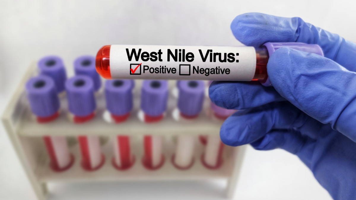 O cutie de eprubete cu probe de sânge, fiecare eprubetă are un capac mov. Un medic ține în mână o eprubetă pe care scrie „West Nile” posivie