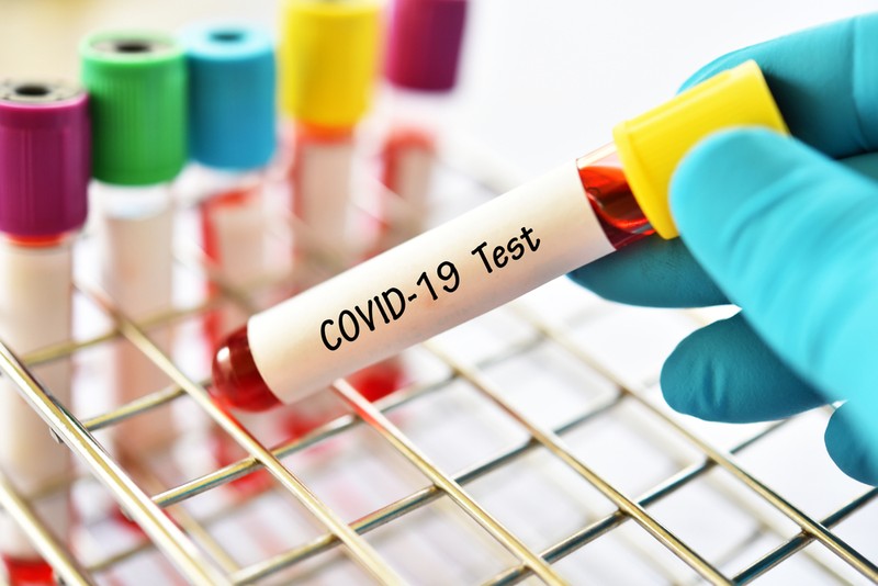 Test pentru depistarea COVID-19