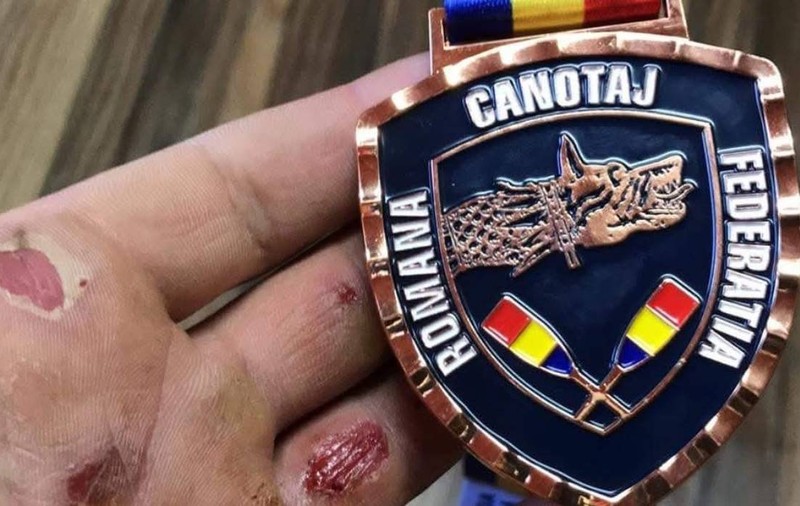 Cum arată mâinile unui medaliat cu aur la Europenele de canotaj: „Cel mai valoros premiu te așteaptă acasă”