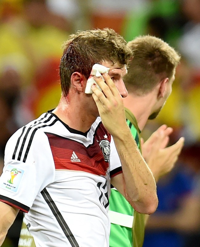 epa04271735 Thomas Mueller (L) of Germany reacts after a collision with John Boye (unseen) of Ghana during the FIFA World Cup 2014 group G preliminary round match between Germany and Ghana at the Estadio Castelao in Fortaleza, Brazil, 21 June 2014. (RESTRICTIONS APPLY: Editorial Use Only, not used in association with any commercial entity - Images must not be used in any form of alert service or push service of any kind including via mobile alert services, downloads to mobile devices or MMS messaging - Images must appear as still images and must not emulate match action video footage - No alteration is made to, and no text or image is superimposed over, any published image which: (a) intentionally obscures or removes a sponsor identification image; or (b) adds or overlays the commercial identification of any third party which is not officially associated with the FIFA World Cup) EPA/GEORGI LICOVSKI EDITORIAL USE ONLY EPA/GEORGI LICOVSKI EDITORIAL USE ONLY EDITORIAL USE ONLY