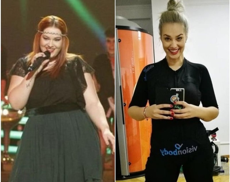 Vedetele din România care și-au tăiat stomacul. Imagini înainte și după operația de slăbit