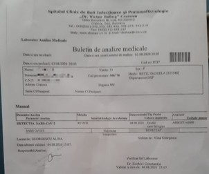 Analiza exudatului nazo-faringian a arătat infecția cu coronavirus