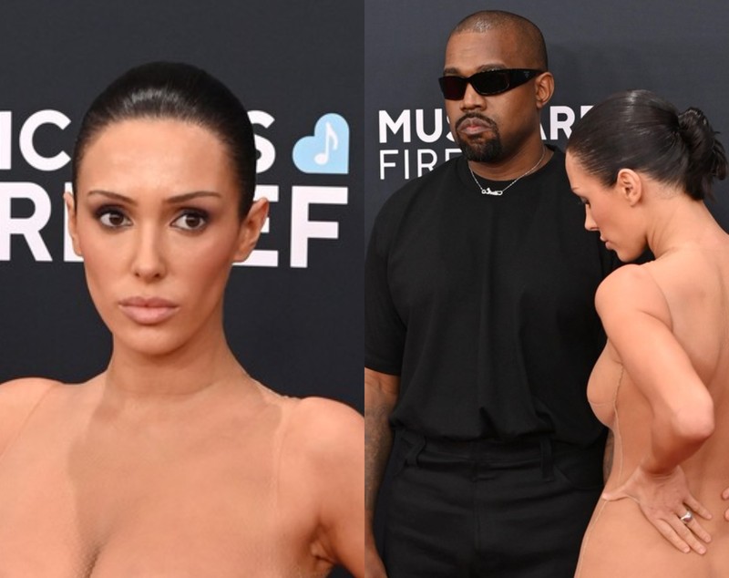 Boala de care suferă Kanye West, după ce a fost diagnosticat greșit cu tulburare bipolară. Anunț după apariția la Grammy 2025 cu Bianca Censori