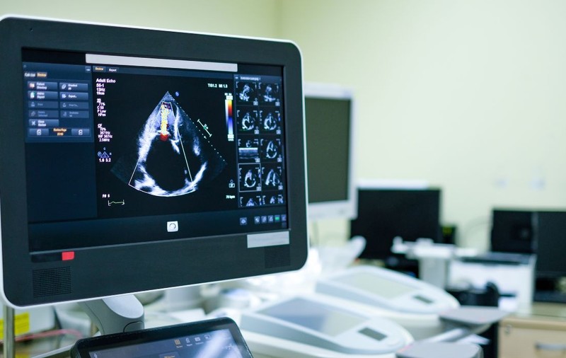 Aparatură de top de peste 350.000 de euro pentru Secția de Chirurgie Cardiovasculară de la Spitalul Marie Curie