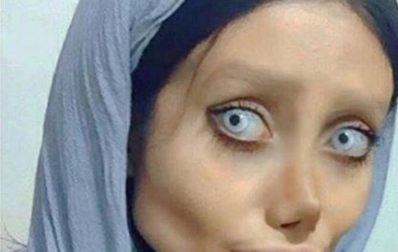 O tânără și-a făcut peste 50 de operații estetice pentru a semăna cu Angelina Jolie | FOTO