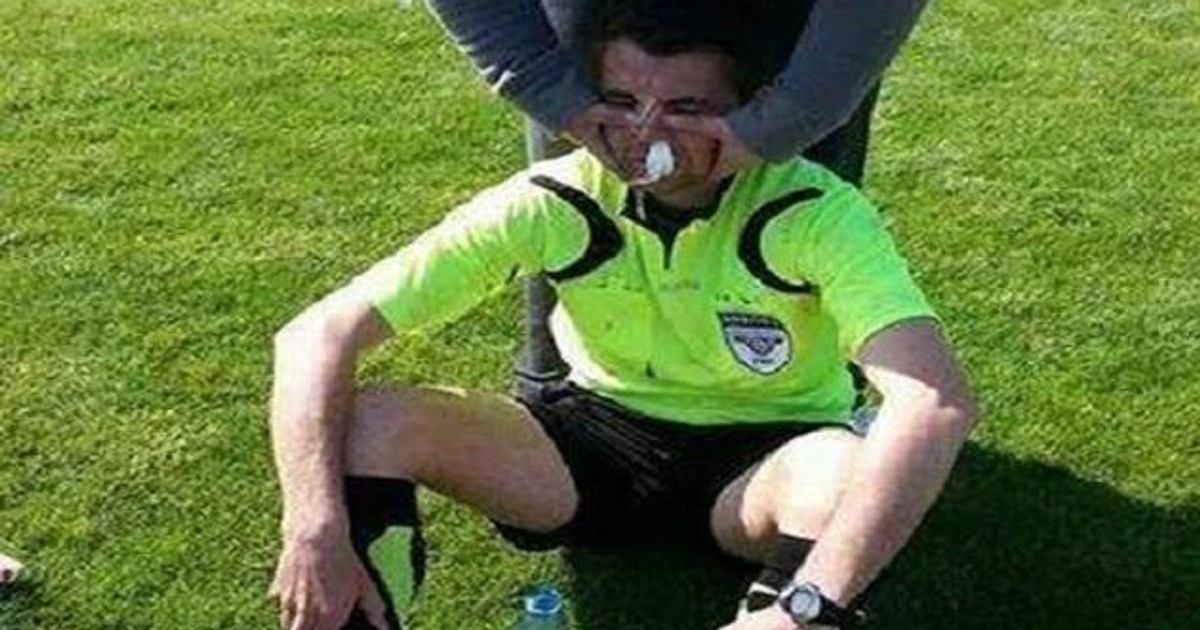 Un politician l-a lovit pe un arbitru minor cu telefonul în cap la un meci de fotbal din România