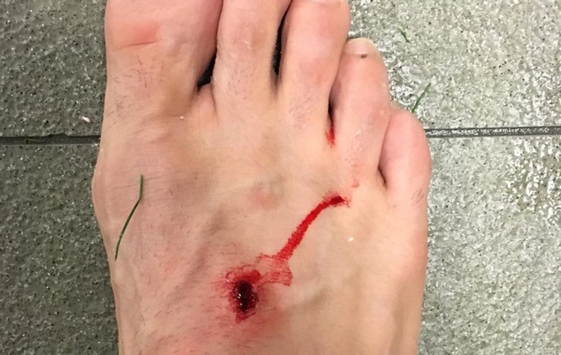 Derby-ul Barcelona - Atletico Madrid s-a lăsat cu răniți. Un jucător și-a postat rana pe Instagram