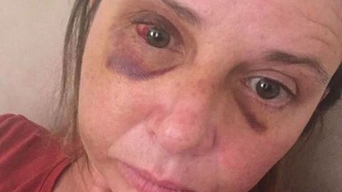 Cuvintele sfâșietoare spuse de un copil de trei ani după ce și-a văzut mama bătută crunt de tatăl lui (foto Jemma Palmer)