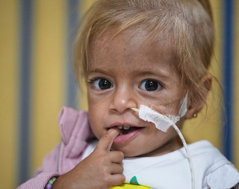 Povestea fetiței de 2 ani evacuată din Gaza și salvată de medici în Italia în ultimul moment: cântărea doar patru kilograme